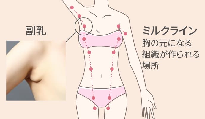 ミルクラインの説明図 - 副乳ができる位置を示す図解